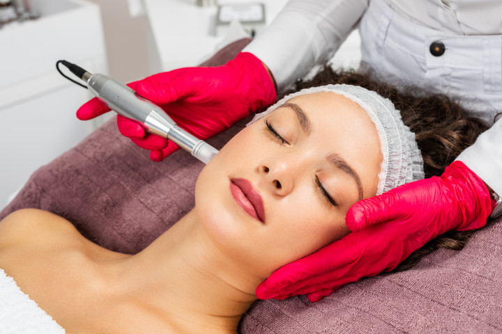 Le microneedling